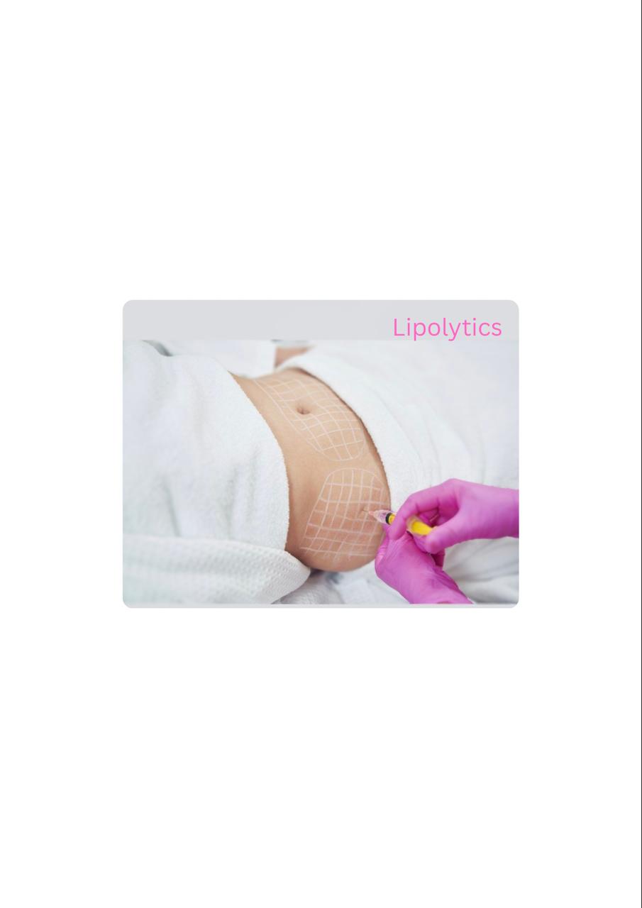 ლიპოლიტიკი